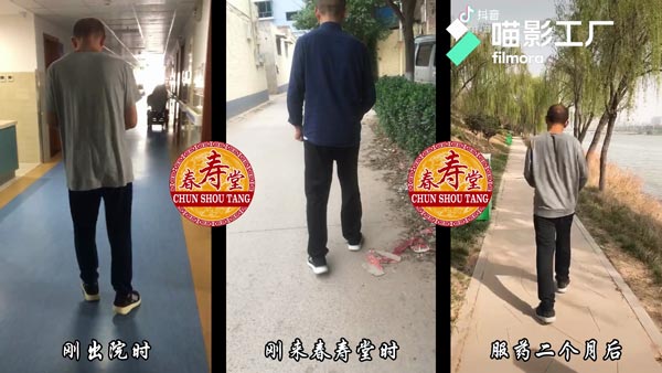 治疗效果